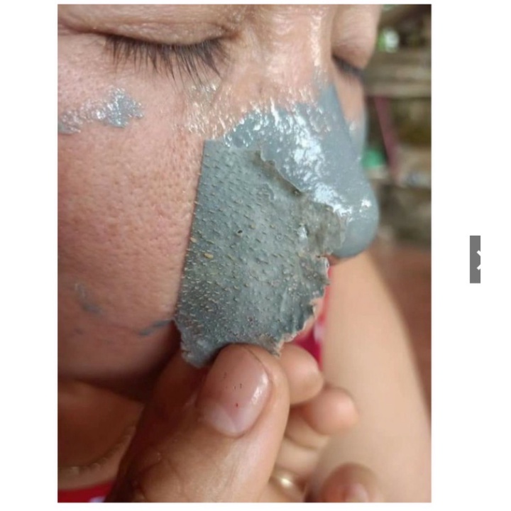 Gel Lột Mụn - Dr.Acne - Hút Sạch Mụn Cám, Mụn Đầu Đen - Sáng Da. Dùng Cá Nhân Salon Tóc Spa Thẩm Mỹ Viện,