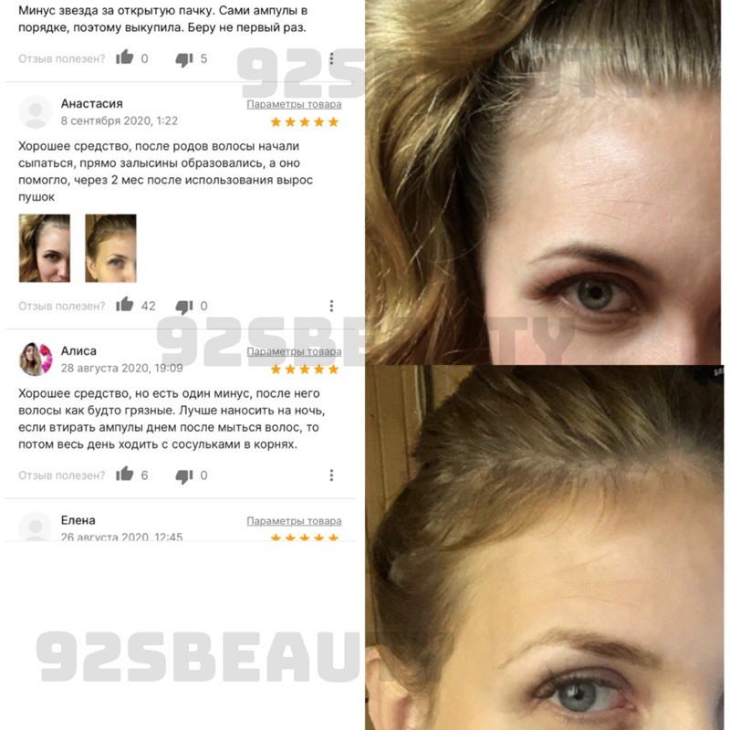 Serum kích thích mọc tóc, ngăn ngừa rụng tóc Compliment Se Selen+ | BigBuy360 - bigbuy360.vn