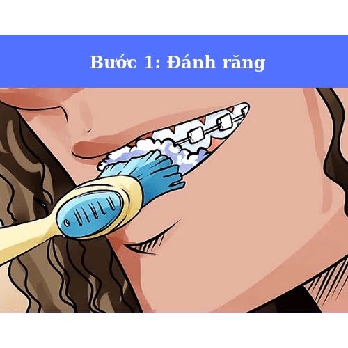 Sáp nha khoa, sáp chỉnh nha 3M, Dental Wax 3M