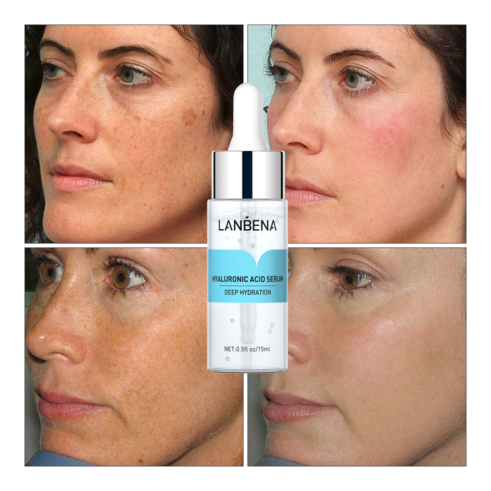 Tinh Chất Chăm Sóc Da LANBENA Hyaluronic Acid Làm Trắng Dưỡng Ẩm Chống Lão Hóa Và Nếp Nhăn 15ml