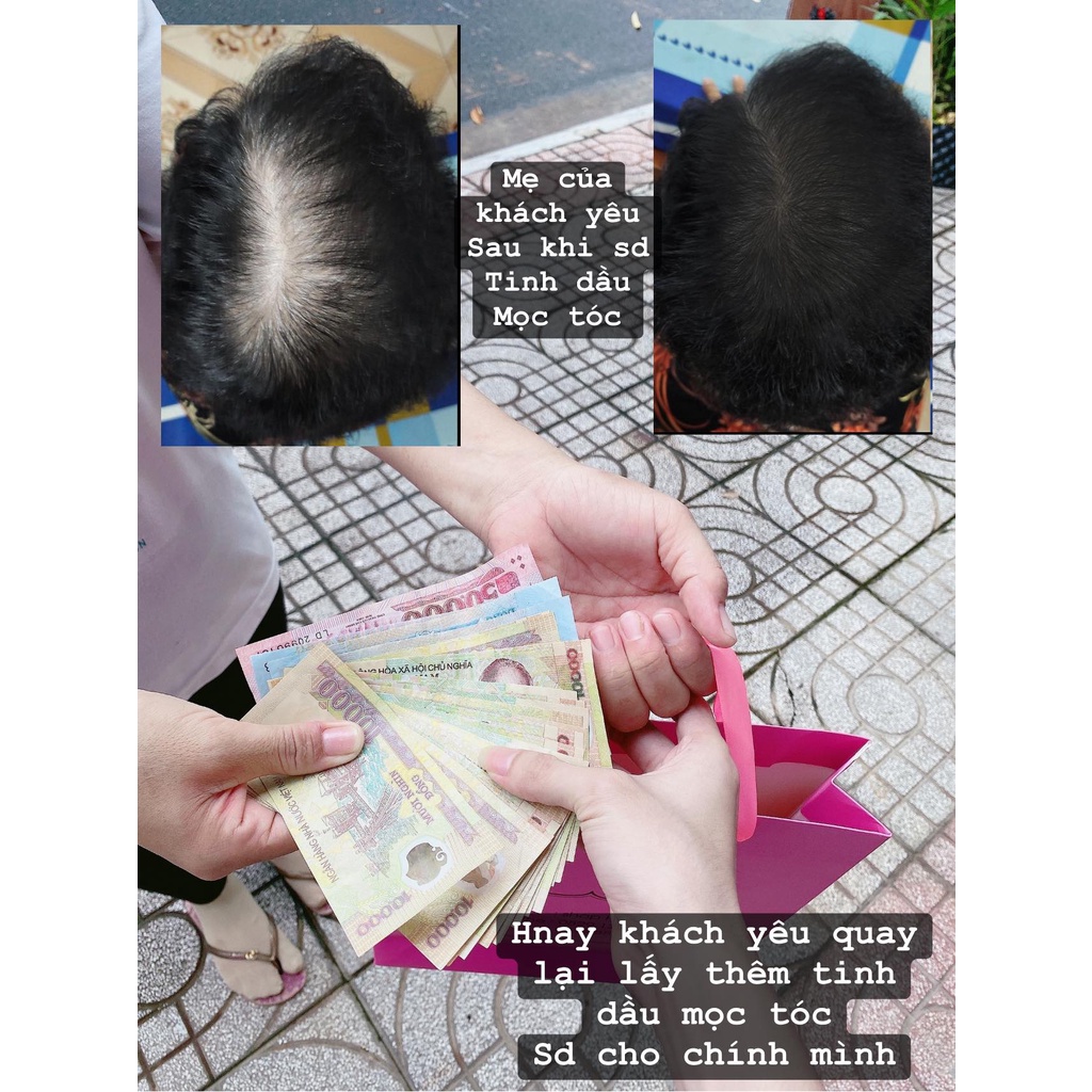 SHOP HIỀN _ TINH DẦU BƯỞI MỌC TÓC