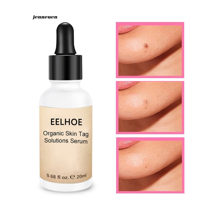 [Hàng mới về] Serum Loại Bỏ Mụn Thịt Dịu Nhẹ Không Gây Kích Ứng Cho Nữ