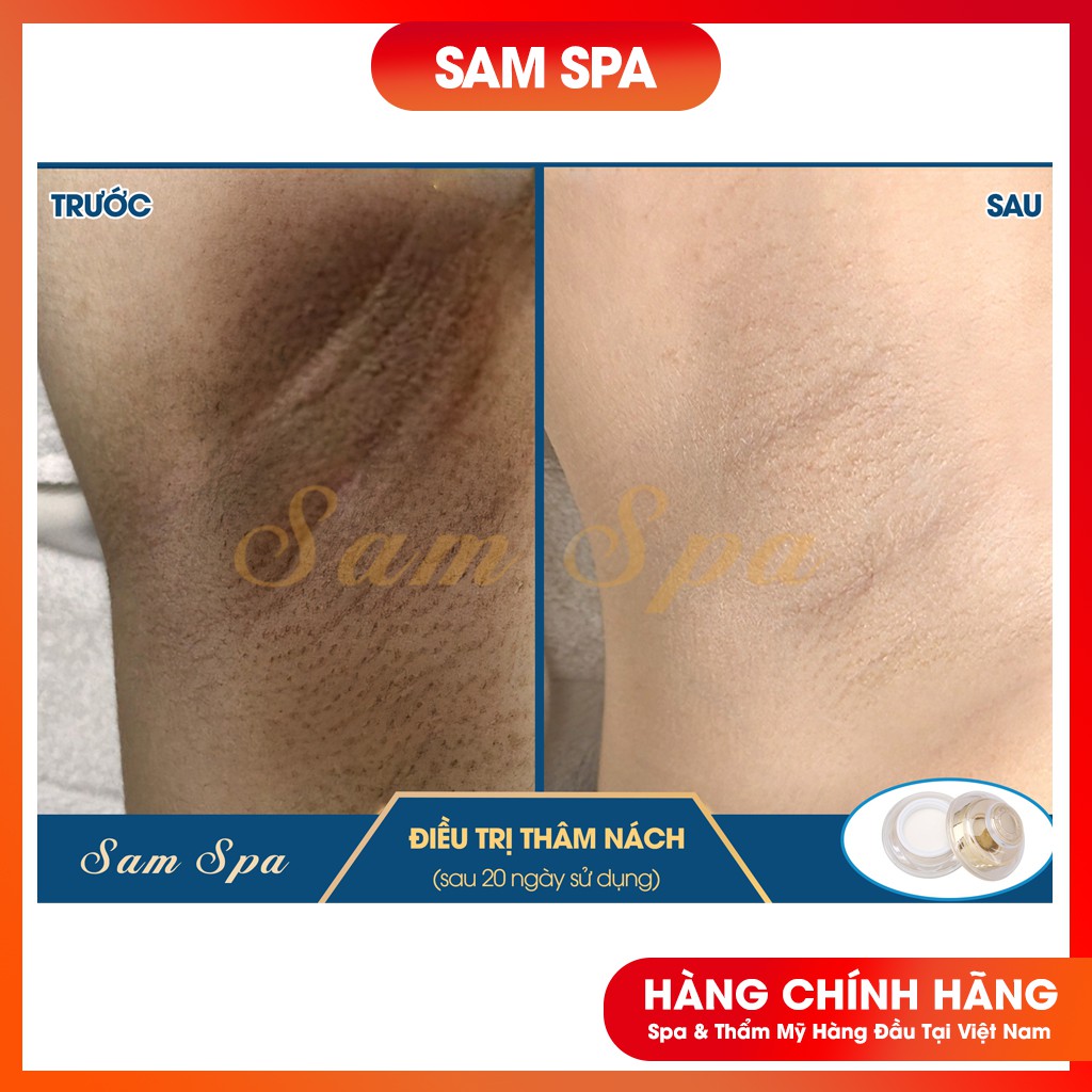 Kem Mờ Thâm Nách, Kem Mờ Thâm Bẹn Hàng Chuẩn Spa 30gr