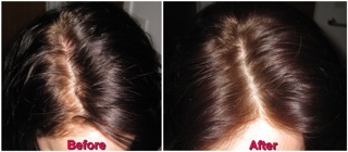Dầu gội khô Batiste Dry Shampoo