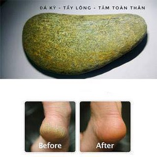 Đá kỳ chân cho người nứt chân, chai chân