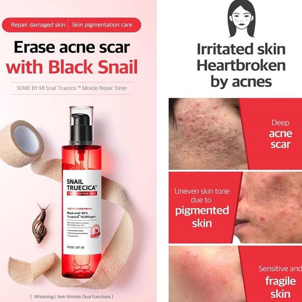 Bộ 3 Sản Phẩm Phục Hồi Da Giảm Sẹo Lõm Some By Mi Snail Truecica (Toner + Serum + Kem)