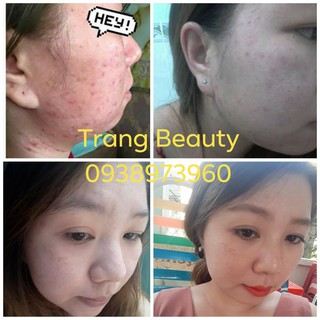 Thuốc Bắc Tái Tạo Da