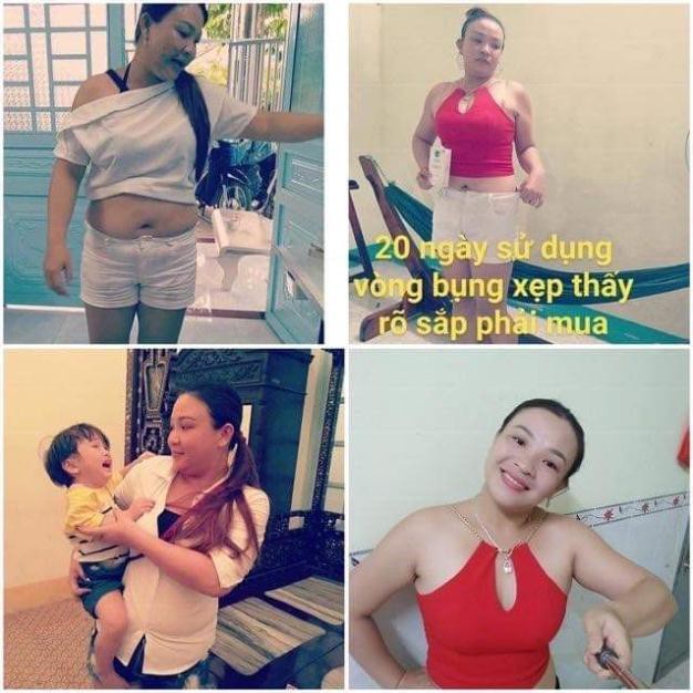 Combo Giảm Cân Cenly Vip Và Kem Tan Mỡ | BigBuy360 - bigbuy360.vn