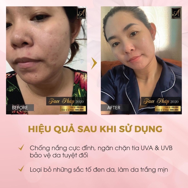 Kem Face Pháp Acosmetics Dưỡng Trắng Da Mặt, Ngừa Mụn, Thâm Nám Tàn Nhang Hũ 50g