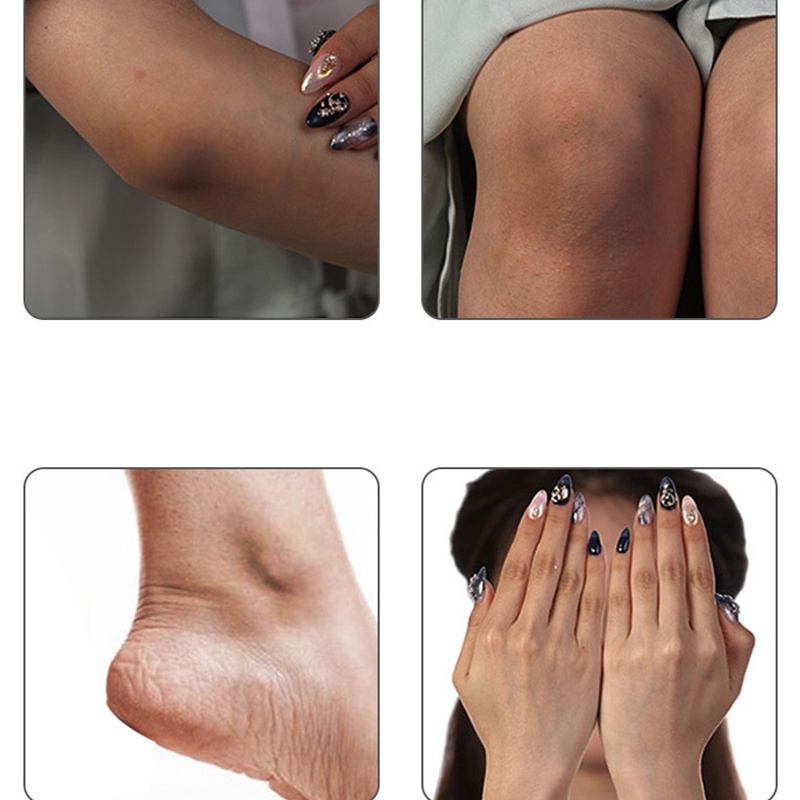 70g YANJIAYI Beauty Factor Joint Melanin Eemovermelatonin Whitening Brighten The Skin Tone Hydrating Moisturizing Cream