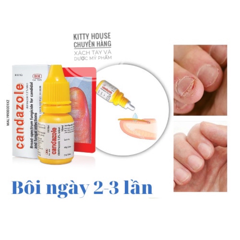 Dung Dịch Loại Bỏ Nấm Móng Tay, Móng Chân Candazole Lotion chai 10ml.