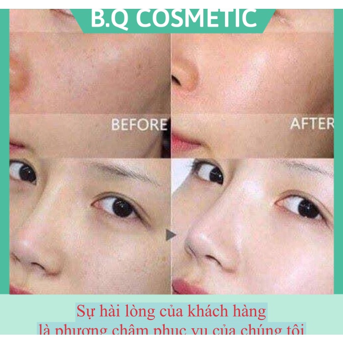 [New 2019] Serum Ngừa Nám Dongsung Miskos Whitening Mist