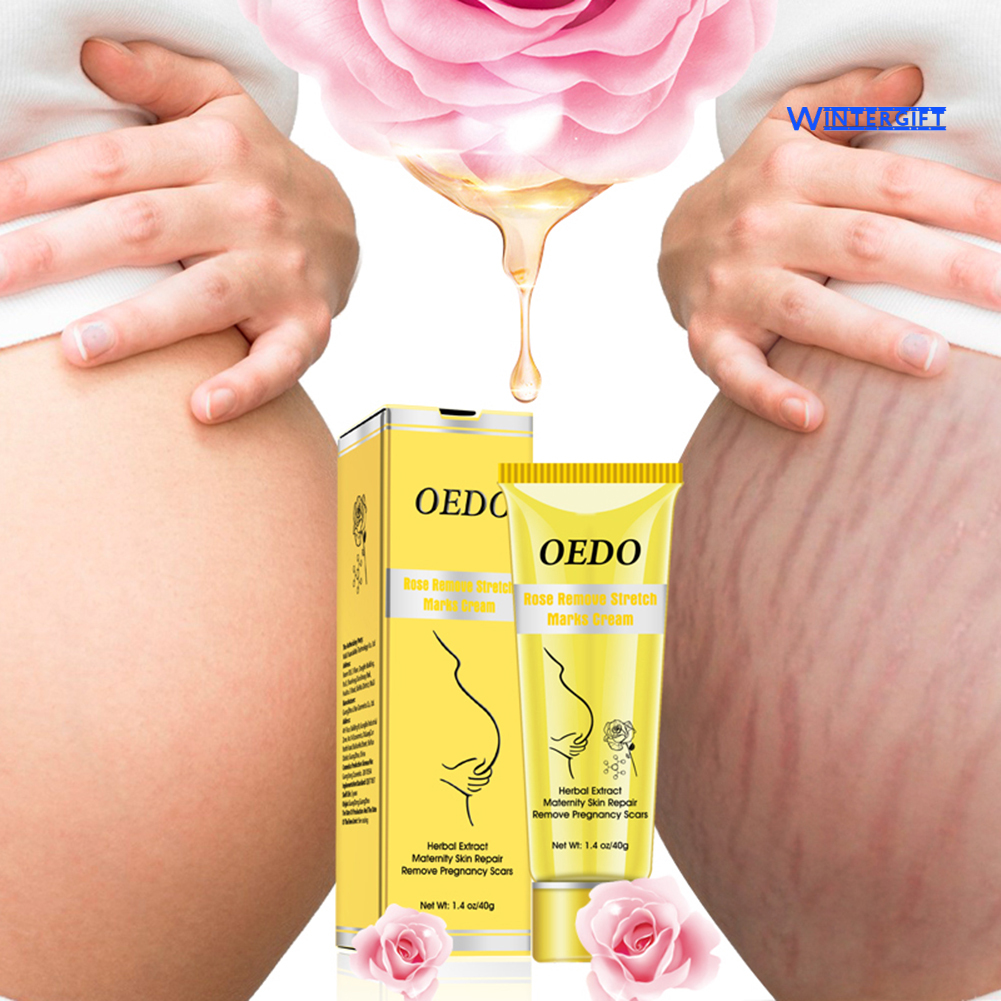 (hàng mới về) kem hỗ trợ giảm rạn da oedo chống nếp nhăn cho phụ nữ mang thai
