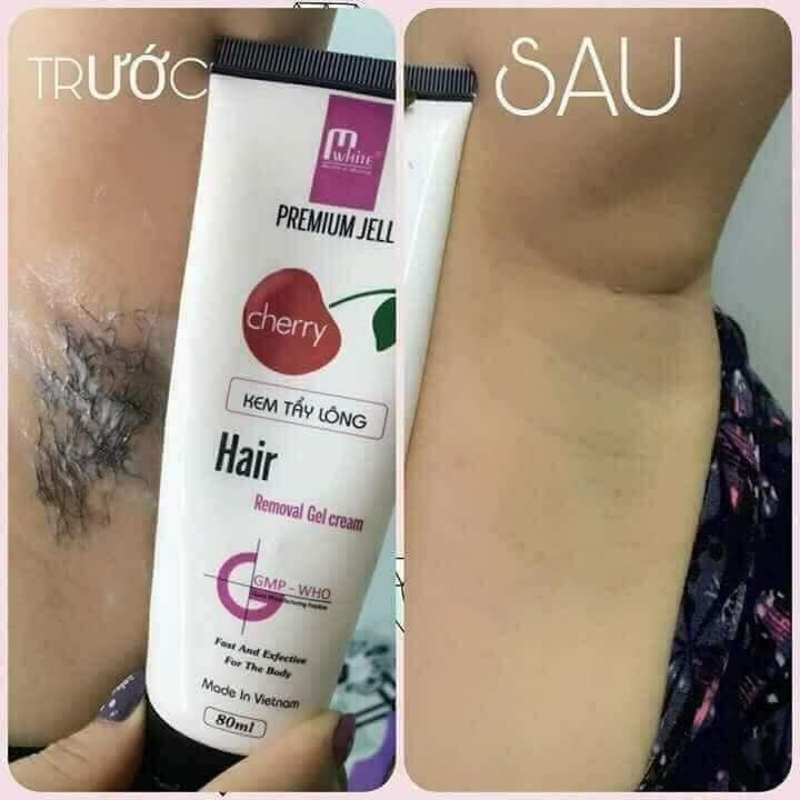 Kem Tẩy Lông Cherry [ TẶNG NẠ VITAMIN ] | BigBuy360 - bigbuy360.vn