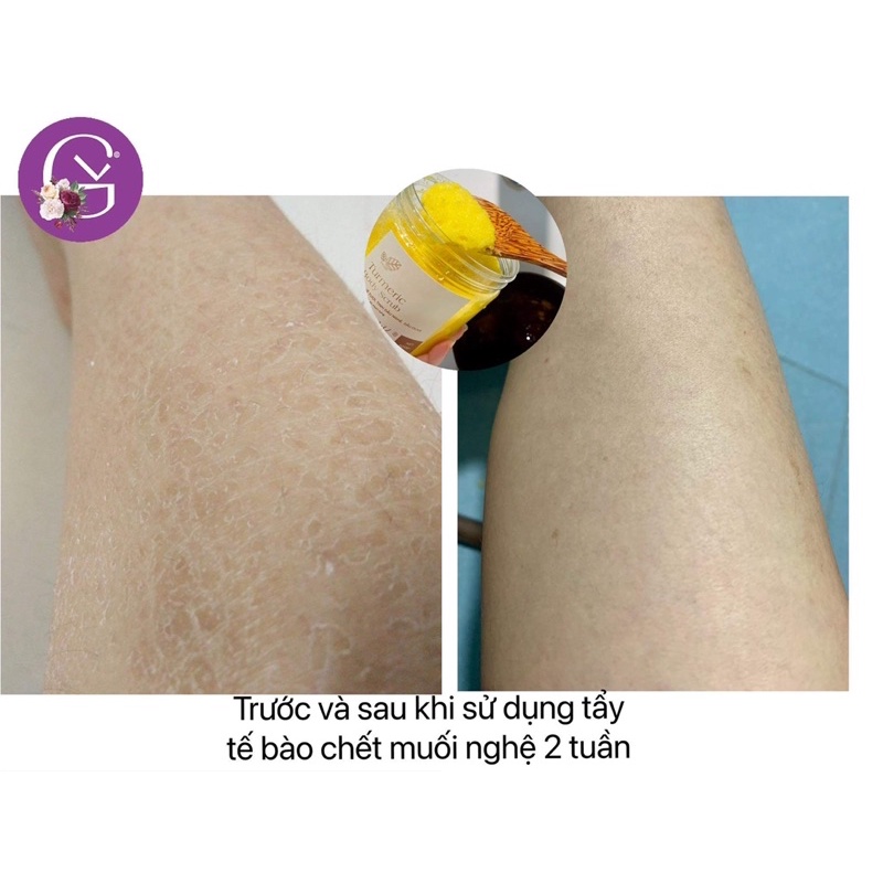 1KG TẨY TẾ BÀO CHẾT BODY MUỐI NGHỆ MỊN DA