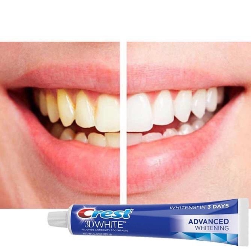 ĐỦ BILL - Kem Đánh Răng Crest 3D White Advanced Tripple Whitening Mỹ - KEM TRẮNG RĂNG 158GR