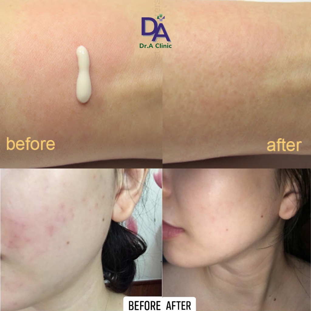 Kem Dưỡng Ẩm Phục Hồi Da Bioderma Tím Cicabio Cream 40ml cho da khô và da nhạy cảm cực lành tính - Dr.A Clinic