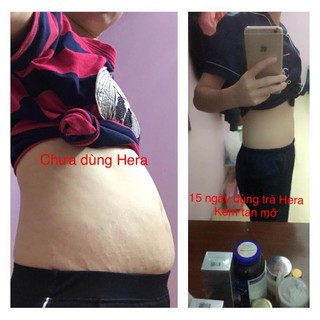 Kem tan mỡ hera