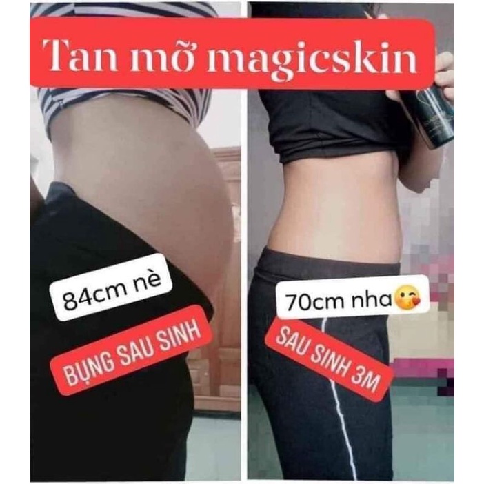 KEM TSN MỠ MAGIC SKIN