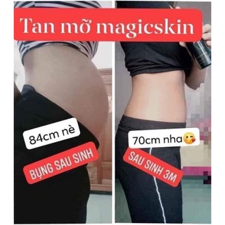 Kem tsn mỡ magic skin