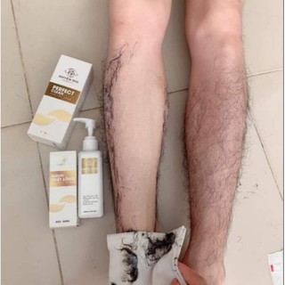 Kem Tẩy Lông Huyền Phi Tặng Serum Triệt Lông - Sạch Lông An Toàn, Không Đau Rát, Dưỡng Da Mền Mại