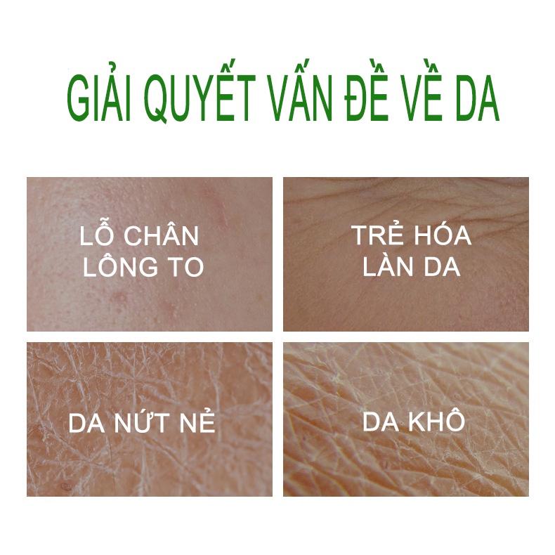 Mặt nạ ngủ rau má dưỡng da, cấp ẩm dành cho da khôtrẻ hóa làn da giúp se khít lỗ chân lông trẻ hóa MOCCO Nội địa trung