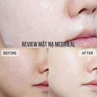Mặt nạ Mediheal Mask 27ml