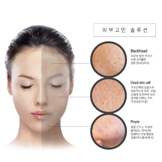 MẶT NẠ THẢI ĐỘC SỦI BỌT THAN HOẠT TÍNH,TRO NÚI LỬA GIÚP SẠCH TẬN SÂU LỖ CHÂN LÔNG