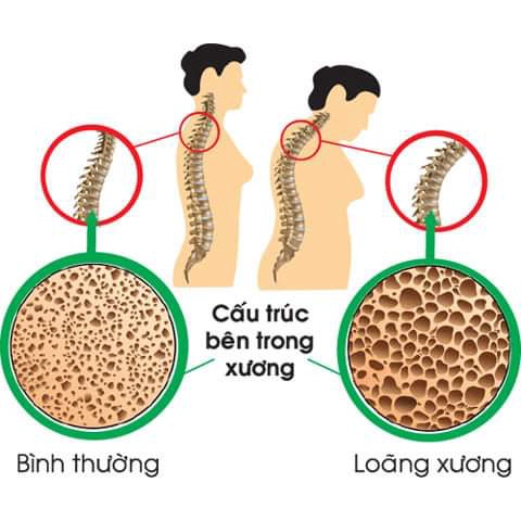 Lon Sữa Bột Dinh Dưỡng Nucalci Gold Nutifood 900gr Dành Cho Ngừời Từ 51 Tuổi Trở Lên Giúp Xương Chắc Khỏe