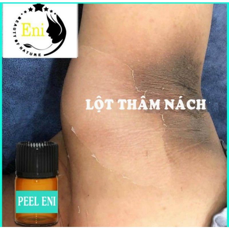 ENI LỘT TRẮNG DA NÁCH HẾT THÂM