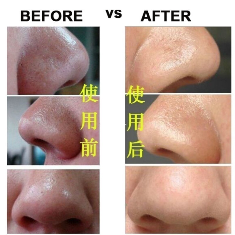 Set 15 Mặt Nạ Than Tre Lột Mụn Đầu Đen Làm Sạch Sâu Lỗ Chân Lông
