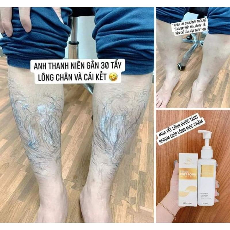 KEM TRIỆT LÔNG HUYỀN PHI ( TẶNG KÈM SERUM TRIỆT)