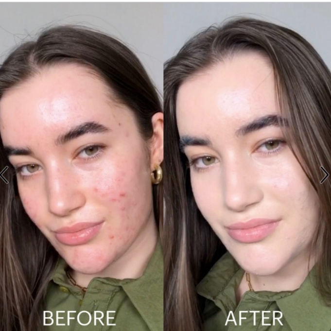 Kem dưỡng Dr.Jart+ Cicapair Tiger Grass Color Correcting Treatment