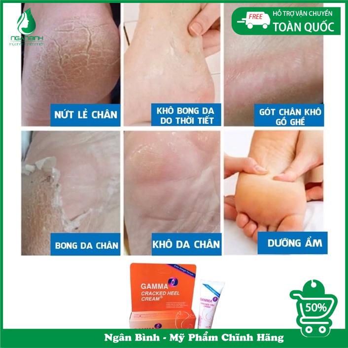 Kem giảm nứt gót chân, khô nứt da Gamma Cracked Heel sản phẩm chuyên dùng cho da khô nứt nẻ cho kết quả cực kỳ tốt. ...