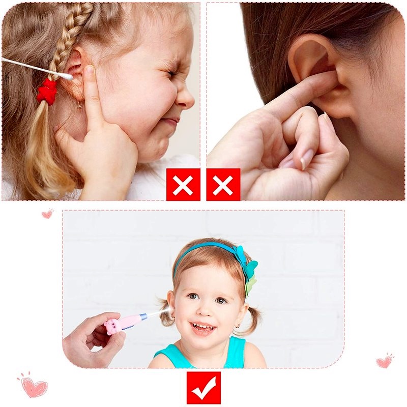 Dụng Cụ Lấy Ráy Tai Có Đèn LED Hình Động Vật Hoạt Hình Dễ Thương Cho Bé