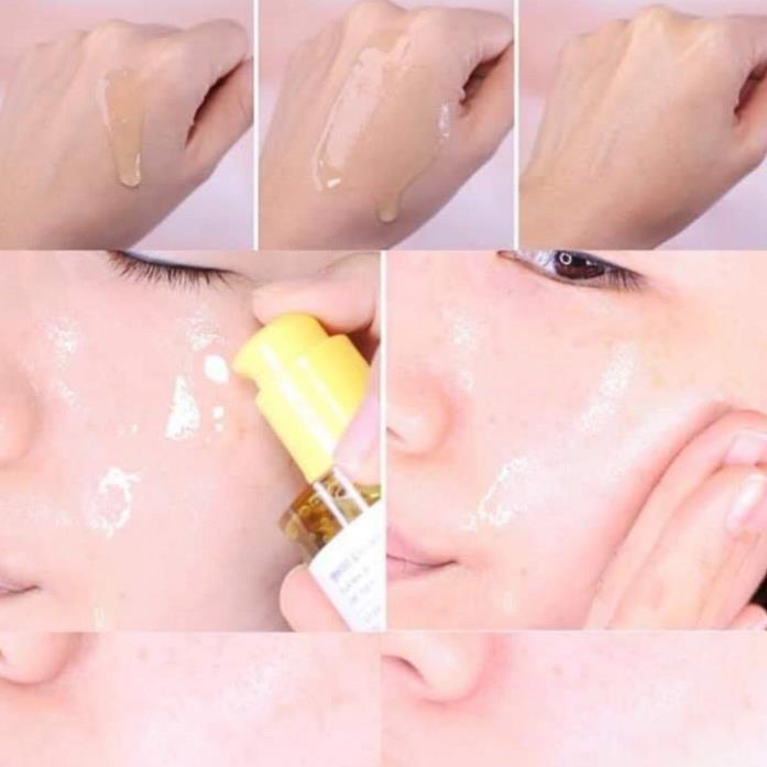 Serum Yuja Niacin Blemish Care 50ml của Some By Mi hỗ trợ sáng da mờ vết thâm | BigBuy360 - bigbuy360.vn