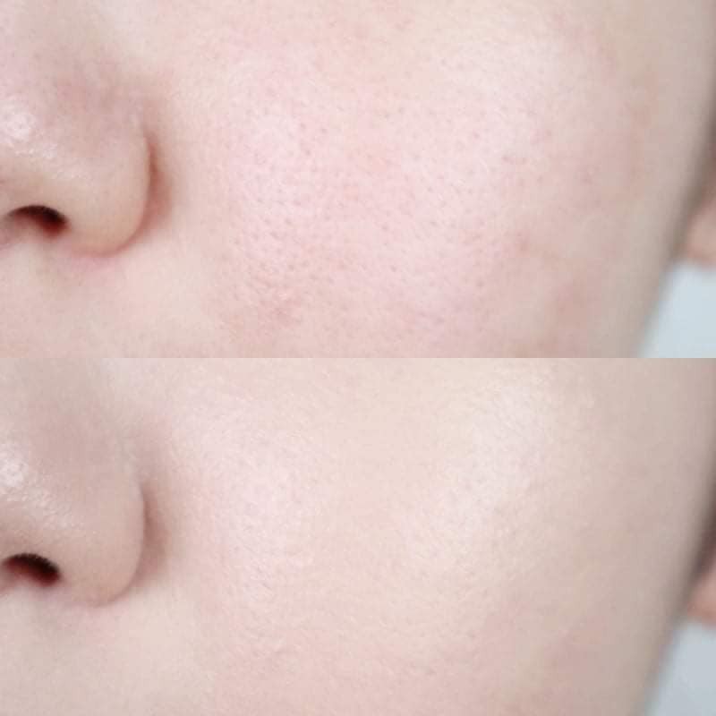 Phấn nước 𝐂𝐔𝐒𝐇𝐈𝐎𝐍 𝐀𝐏𝐈𝐄𝐔 𝐂𝐎𝐕𝐄𝐑-𝐏𝐀𝐍𝐆 𝐀𝐓𝐓𝐄𝐍𝐓𝐈𝐎𝐍 𝐓𝐄𝐍𝐒𝐈𝐎𝐍 (dòng Perfect cover) tone 22 | BigBuy360 - bigbuy360.vn