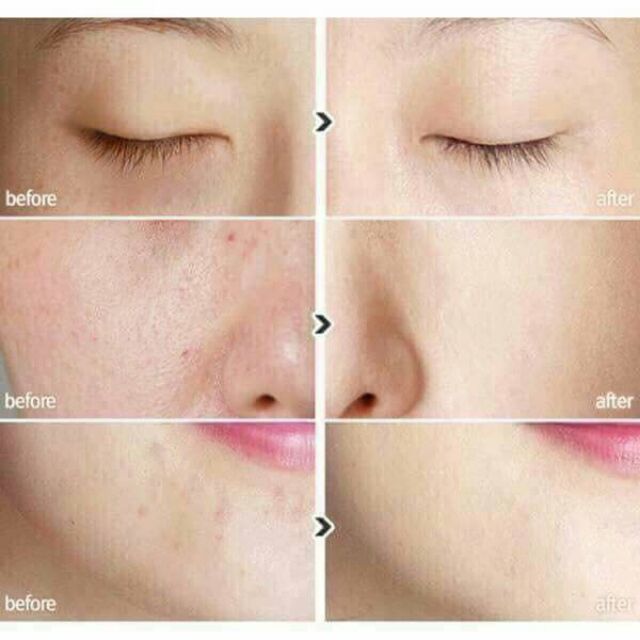 KEM NỀN BB CREAM 4U