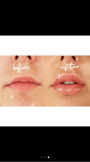 Son dưỡng căng mọng môi LIP FILLER
