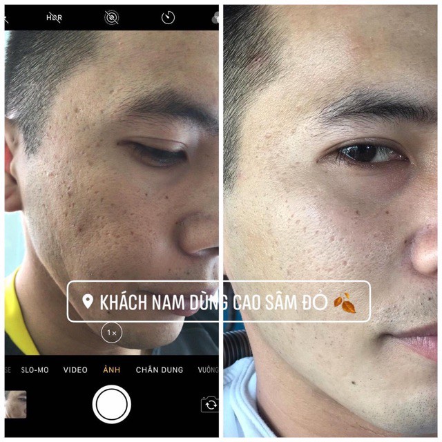 36VỊ - CAO MỤN SÂM ĐỎ 15GR | BigBuy360 - bigbuy360.vn