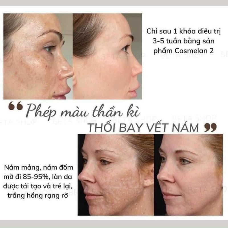 Kem Giảm Nám Mesoestetic Cosmelan 2[Bản Mới]