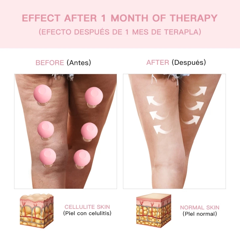 [Hàng mới về] Cốc giác hơi massage cơ thể bằng chất liệu silicon sử dụng tiện lợi
