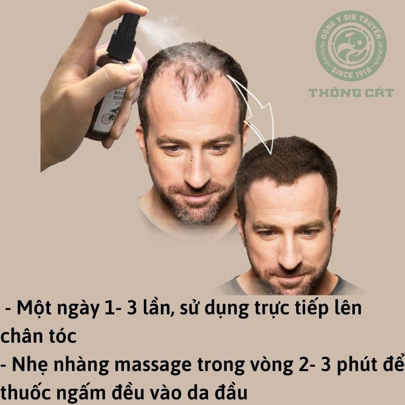 Xịt mọc tóc Đông y gia truyền Thông Cát (Since 1918)_kích thích mọc tóc nhanh dài, giảm rụng tóc, nuôi dưỡng chân tóc