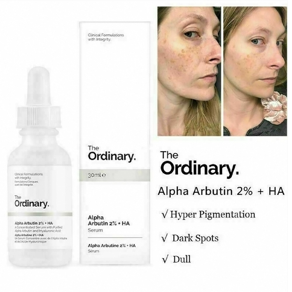 The Ordinary Alpha Arbutin 2% + HA 30ml