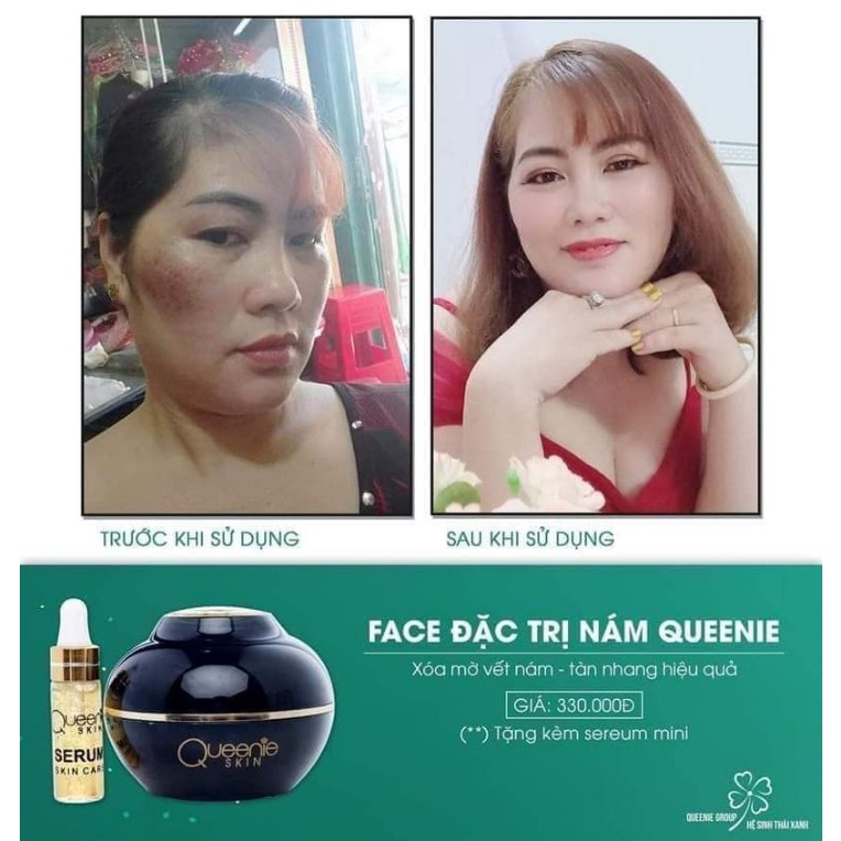 Kem trị_nám, kem dưỡng trắng da chống_lão_hóa mỹ phẩm Queenie Skin tặng kèm serum mini.