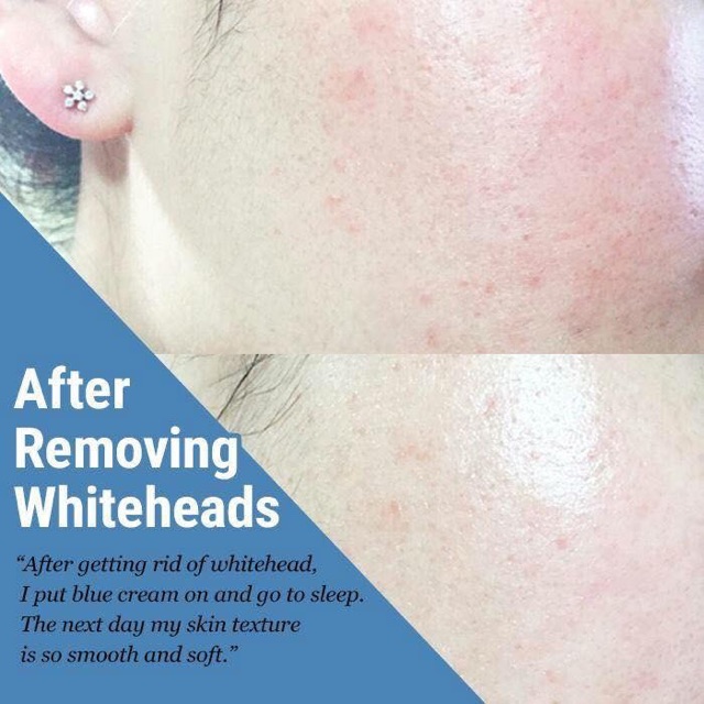  Kem Dưỡng Da Phục Hồi Klairs Midnight Blue Calming Cream | BigBuy360 - bigbuy360.vn