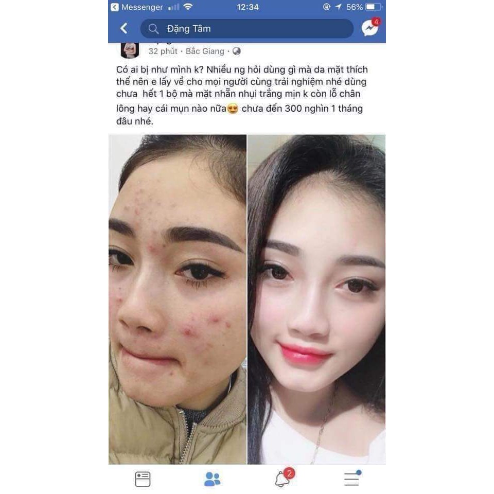 Kem hoa cúc pau jen pai(1 ngày 1 đêm) | BigBuy360 - bigbuy360.vn