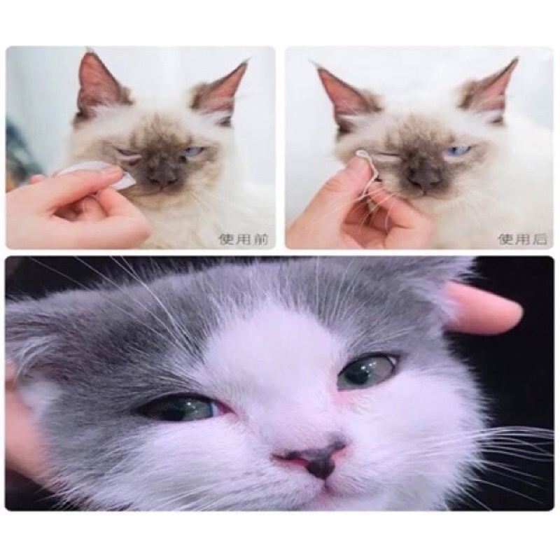 Khăn lau mắt Eye Wipes