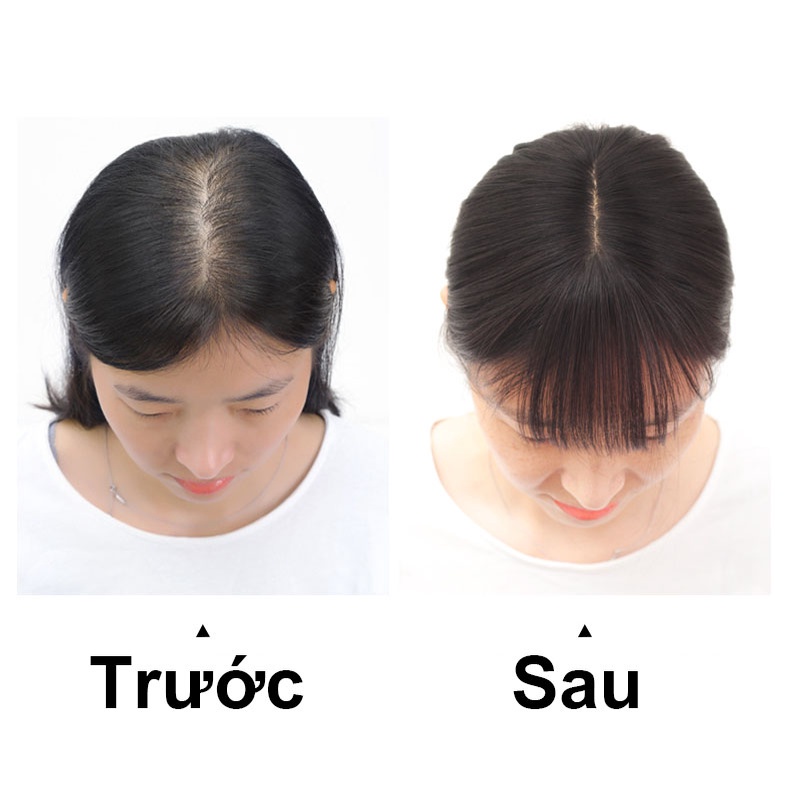 Tóc giả che hói Koty Beauty tóc giả mái thưa phủ hói cao cấp