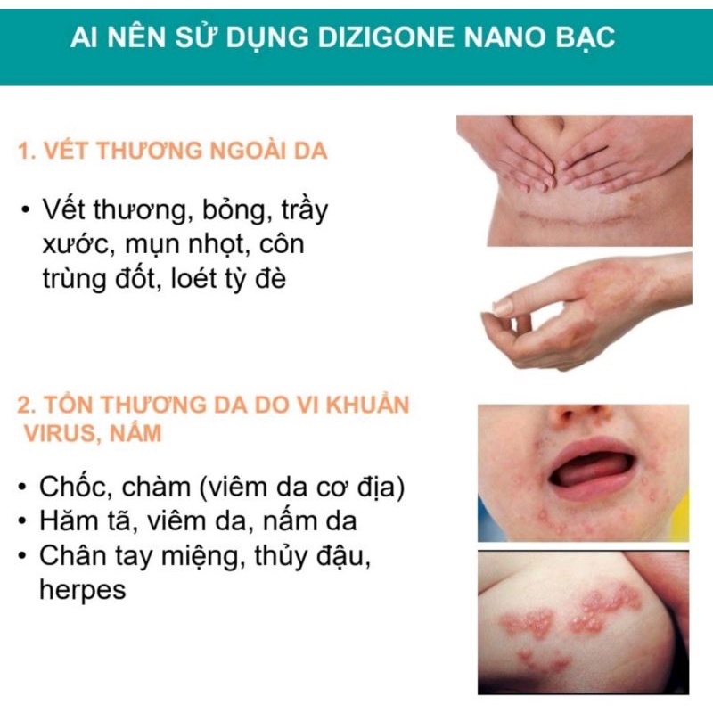 Dizigone nano bạc ⚡ Tặng quà ⚡ Tuýp 25g Giúp kháng khuẩn, lành vết thương, tái tạo da, ngăn ngừa sẹo